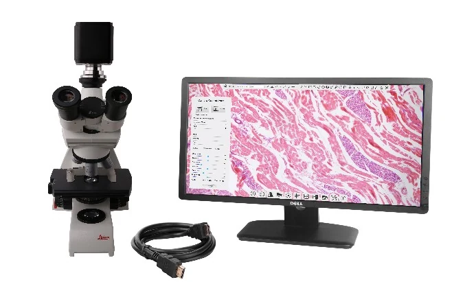 XCAMLITE4K HDMI/USB Multi-outputs 4K SONY Microscope Camera