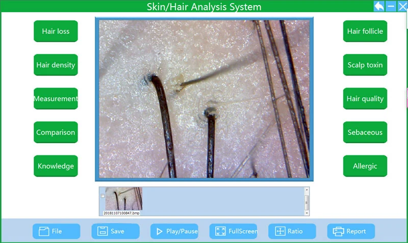 HT-BW36 WiFi Digital Microscope for Skin and Hair Analysis