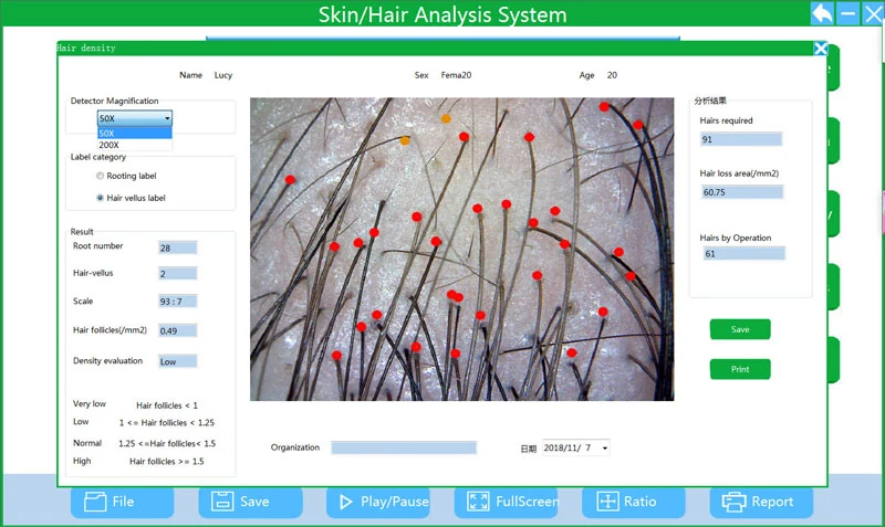 HT-BW36 WiFi Digital Microscope for Skin and Hair Analysis