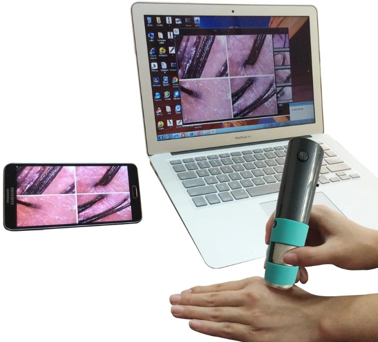 M30F Wireless WiFi Digital Scalp Skin Tester Detector Zoom 600X