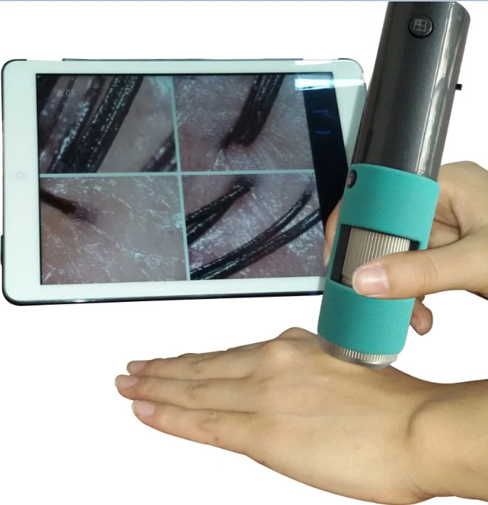 M30F Wireless WiFi Digital Scalp Skin Tester Detector Zoom 600X